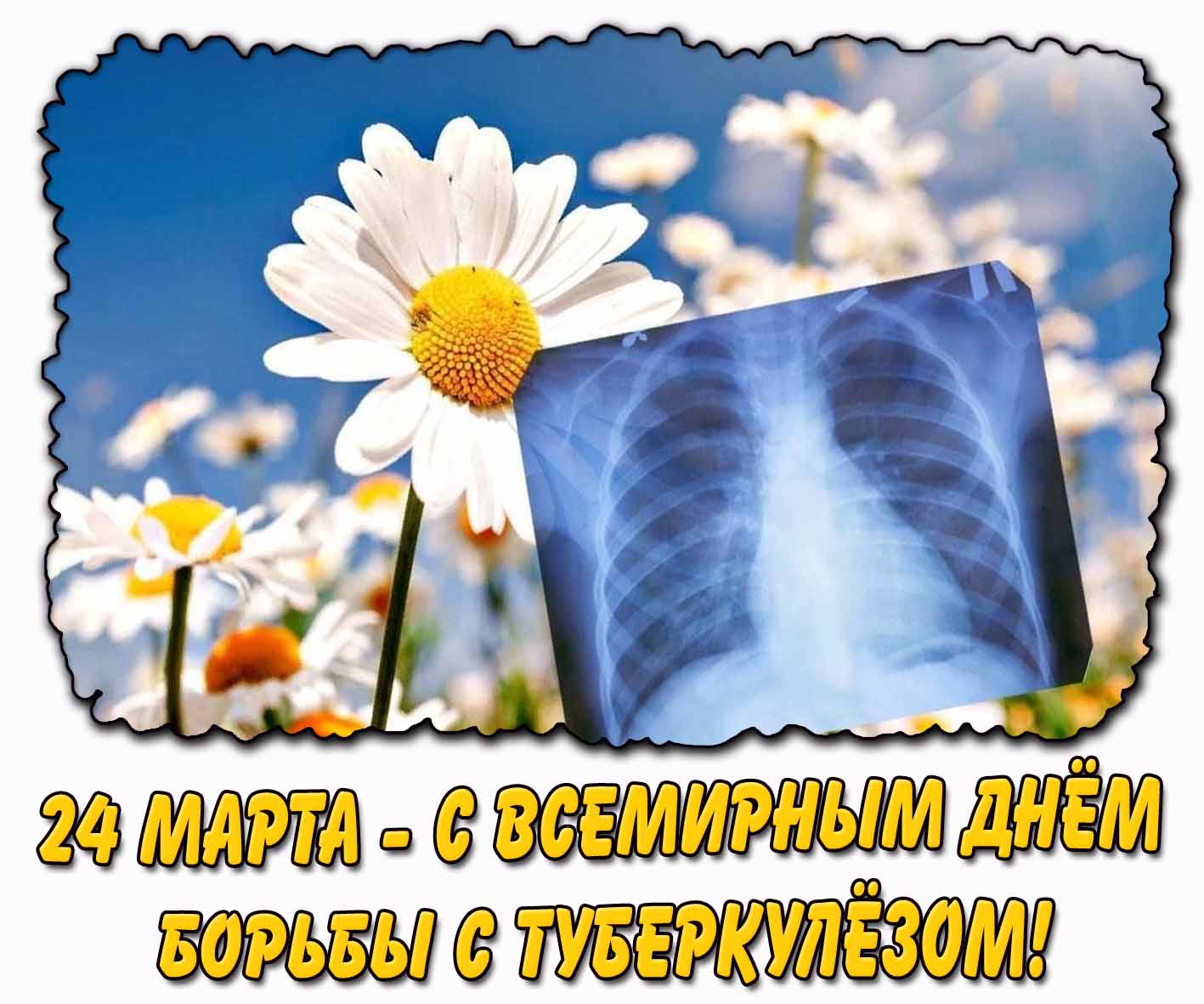 Открытка 24 марта - С Всемирным днём борьбы с туберкулёзом!